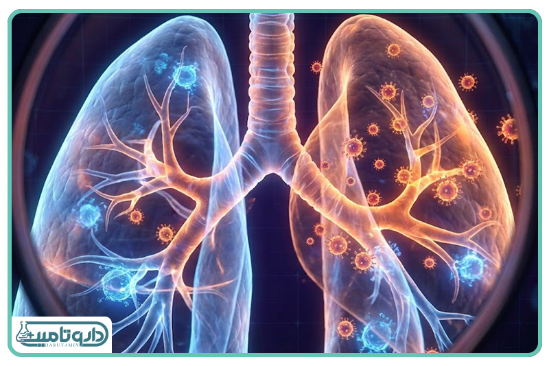 دستگاه تنفسی فوقانی