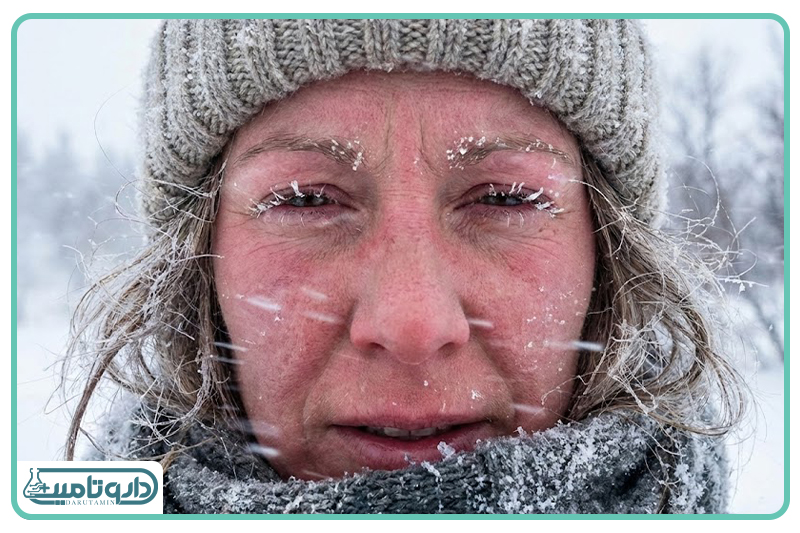 زمستان چگونه رطوبت را از چهره و دستان شما میرباید