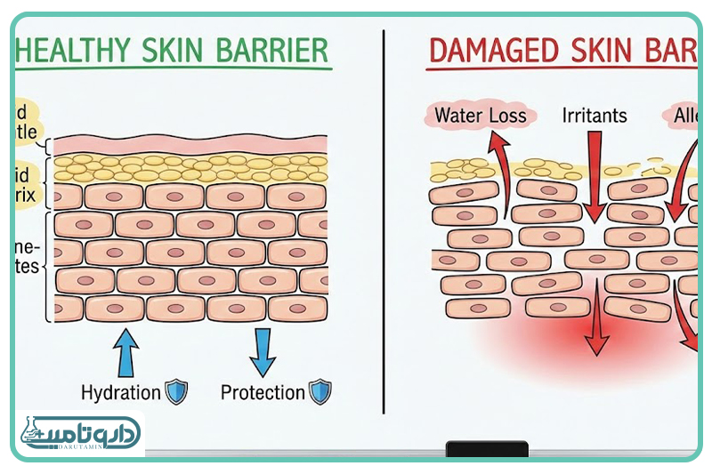 پوست خشک و اتفاقاتی که در لایههای زیرین رخ میدهد