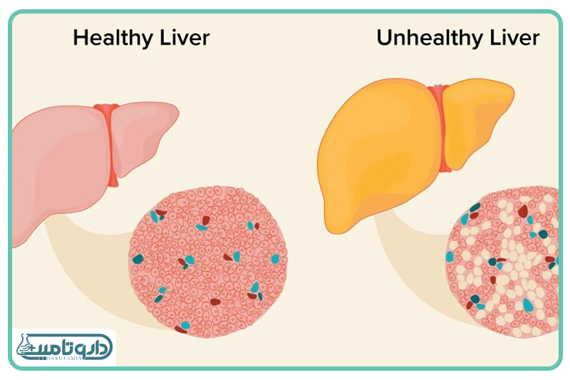 بیماری‌های زمینه‌ای چگونه معادله کاهش وزن را تغییر می‌دهند؟