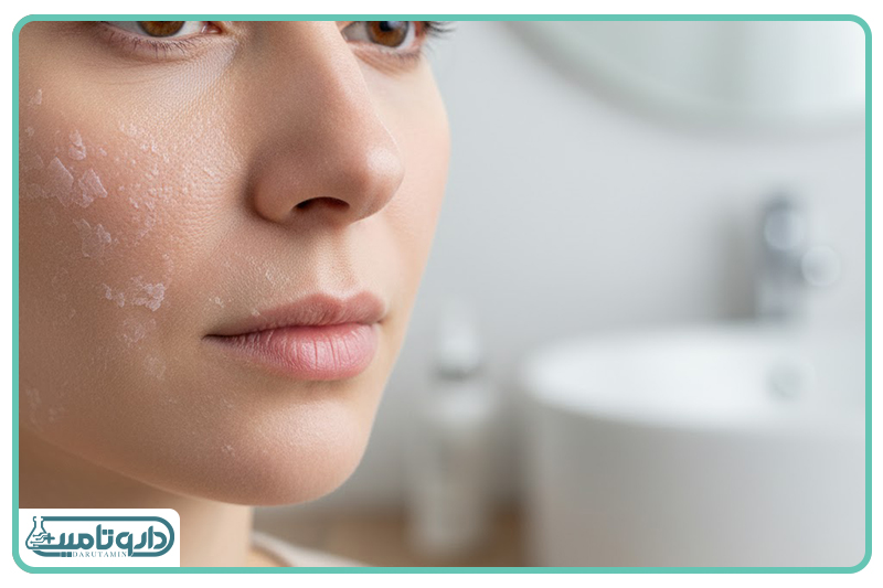 پوستهای مختلط