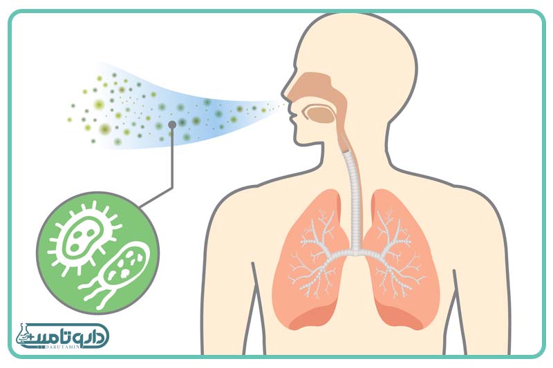 التهاب مجاری تنفسی
