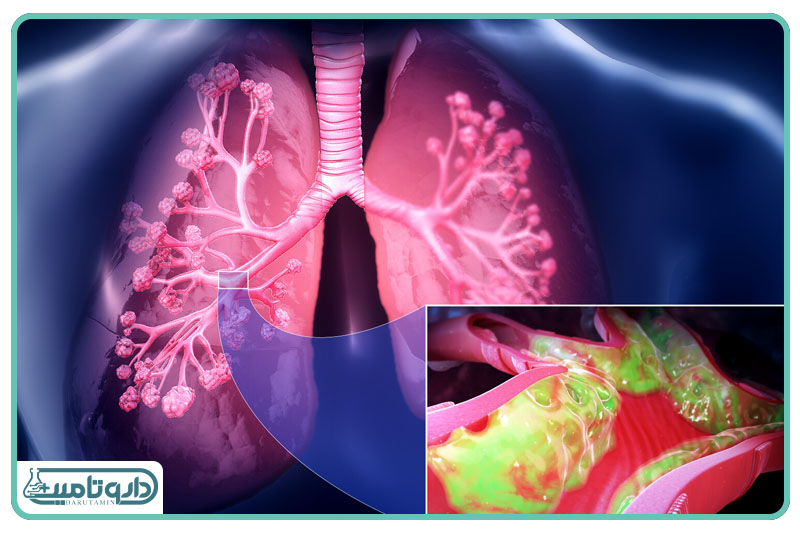 مخاط مجاری تنفسی